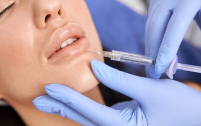 Relleno de labios en Valladolid: volumen, hidratación y armonía natural